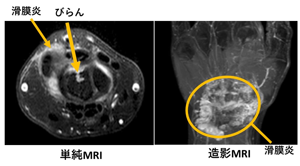 診断基準